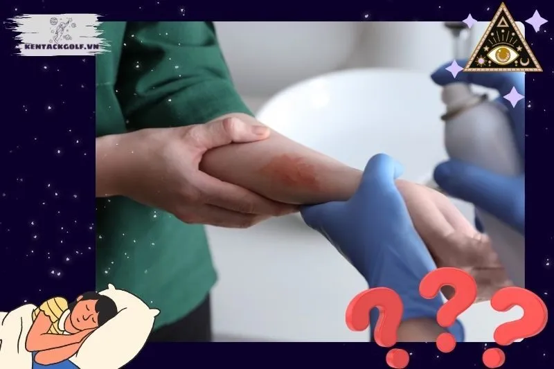 Mối liên hệ giữa giấc mơ bị bỏng và các yếu tố cuộc sống