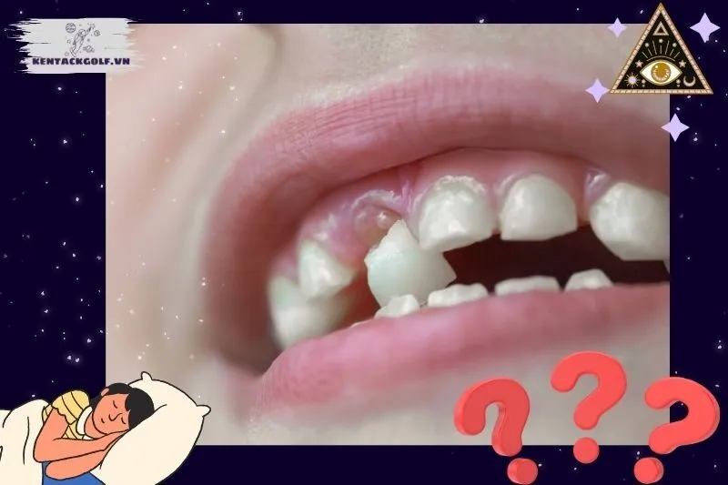 Giấc mơ rụng răng có phải là điềm báo?