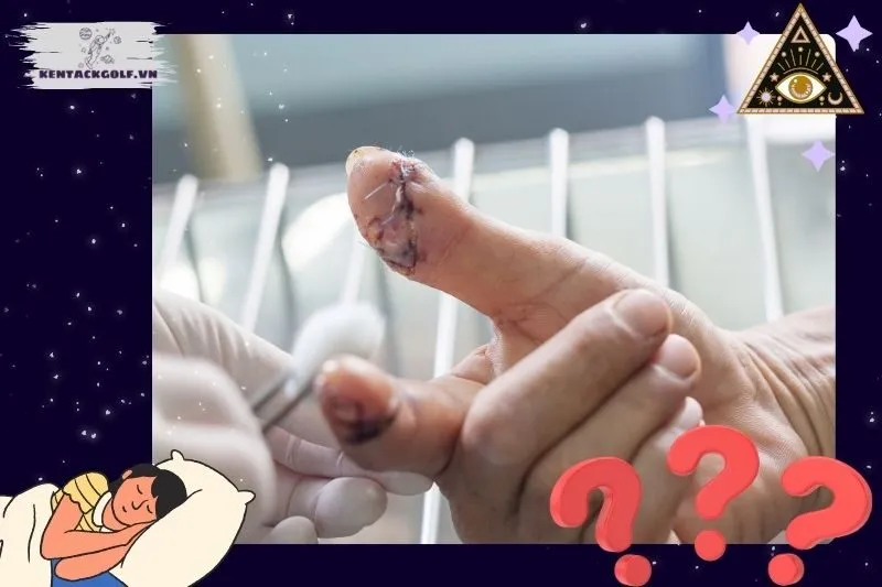 Những trường hợp cụ thể khi nằm mơ thấy đứt tay